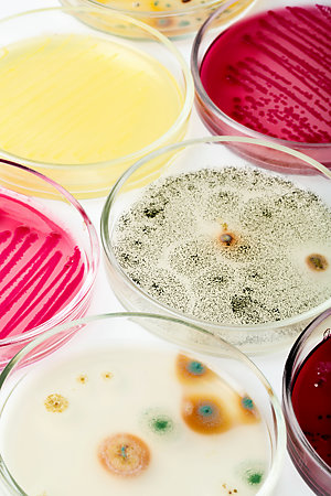 Close-up view of a selection of petri dishes.
